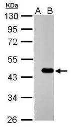 ZBTB24 antibody