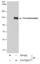Thrombomodulin antibody [C3], 