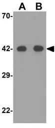 SIGLEC15 antibody