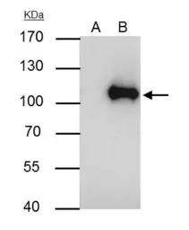 WBP11 antibody