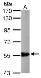 ALDH6A1 antibody