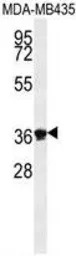 Exonuclease 5 antibody