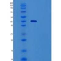 人CD28/TP44(C-Fc)重组蛋白