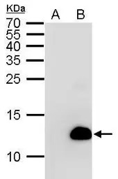 6X His tag antibody [GT359] (H