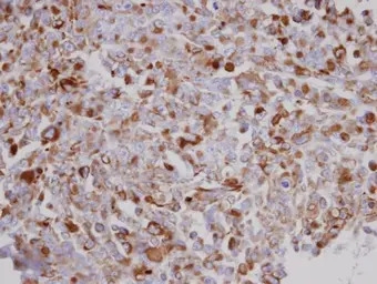 Acylglycerol kinase antibody