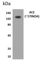ACE antibody [12J16]
