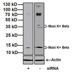 KCNMB1 antibody