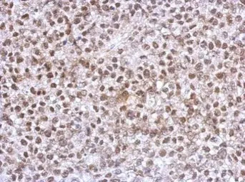 Homeobox C10 antibody