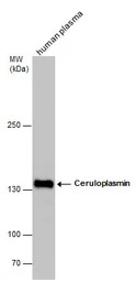 Ceruloplasmin antibody