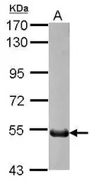 ANGPTL6 antibody
