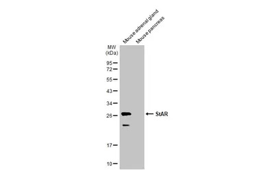 StAR antibody