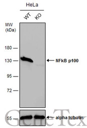 NFkB p100 antibody [C2C3], C-t