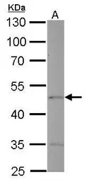 Endothelin B Receptor antibody