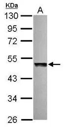 UBAC1 antibody [N2C3]