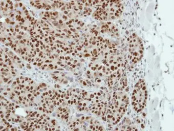 TLE4 antibody [C1C3]