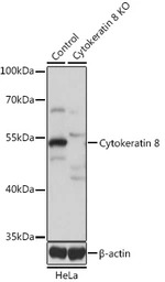 Cytokeratin 8 antibody