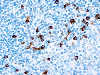 Rabbit Anti-Human IgA antibody