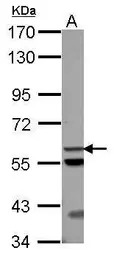 ACOT12 antibody