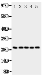 SDC2 antibody