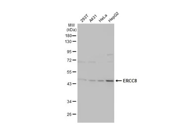 ERCC8 antibody [N2C2], Interna