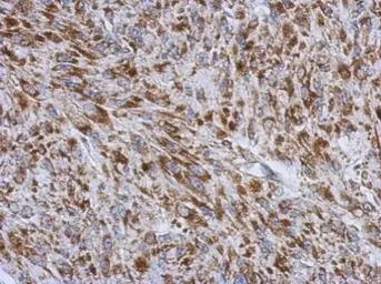 RNF212 antibody