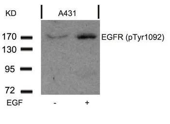 EGFR (phospho Tyr1068) antibod