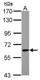 RIPX antibody [N1C1]