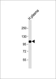 Factor B (Bb fragment) antibod
