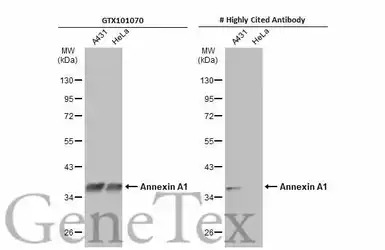 Annexin A1 antibody