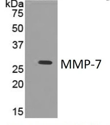 MMP7 antibody [4C21]