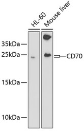 CD70 antibody