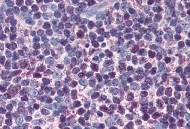 Caspase 3 antibody [31A1067]