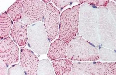 Relaxin Receptor 2 antibody