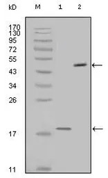 Survivin antibody [2H5H2]