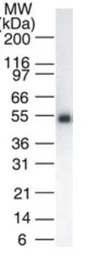 Lck antibody [33D196]
