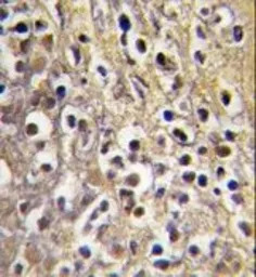 Aromatase antibody, C-term