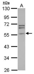 Peripherin antibody