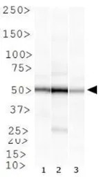 Rad51B antibody [1 H3/13]