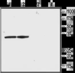 KCNAB2 antibody