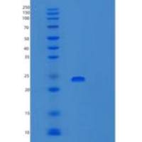 人白细胞介素-10受体亚单位β重组蛋白