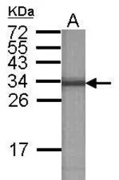 ATP6V1E2 antibody [N1C3]