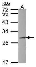 HAUS2 antibody [N1C3-2]