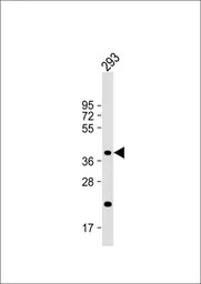 CSGALNACT2 antibody, Internal