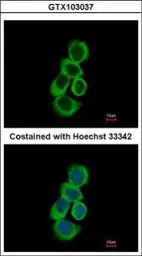 BHMT antibody