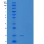 人Profilin-2/PFN2重组蛋白产品图
