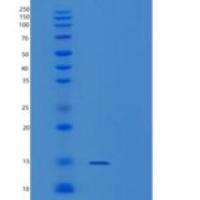 人Profilin-2/PFN2重组蛋白