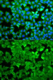 Asparagine synthetase antibody