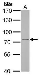 FBXO21 antibody