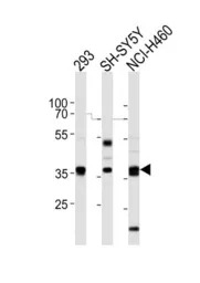 EN1 antibody, N-term