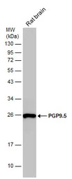 PGP9.5 antibody